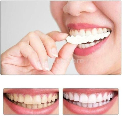 Instant Snap-On Smile Veneers – Natural Looking Fake Teeth Cover